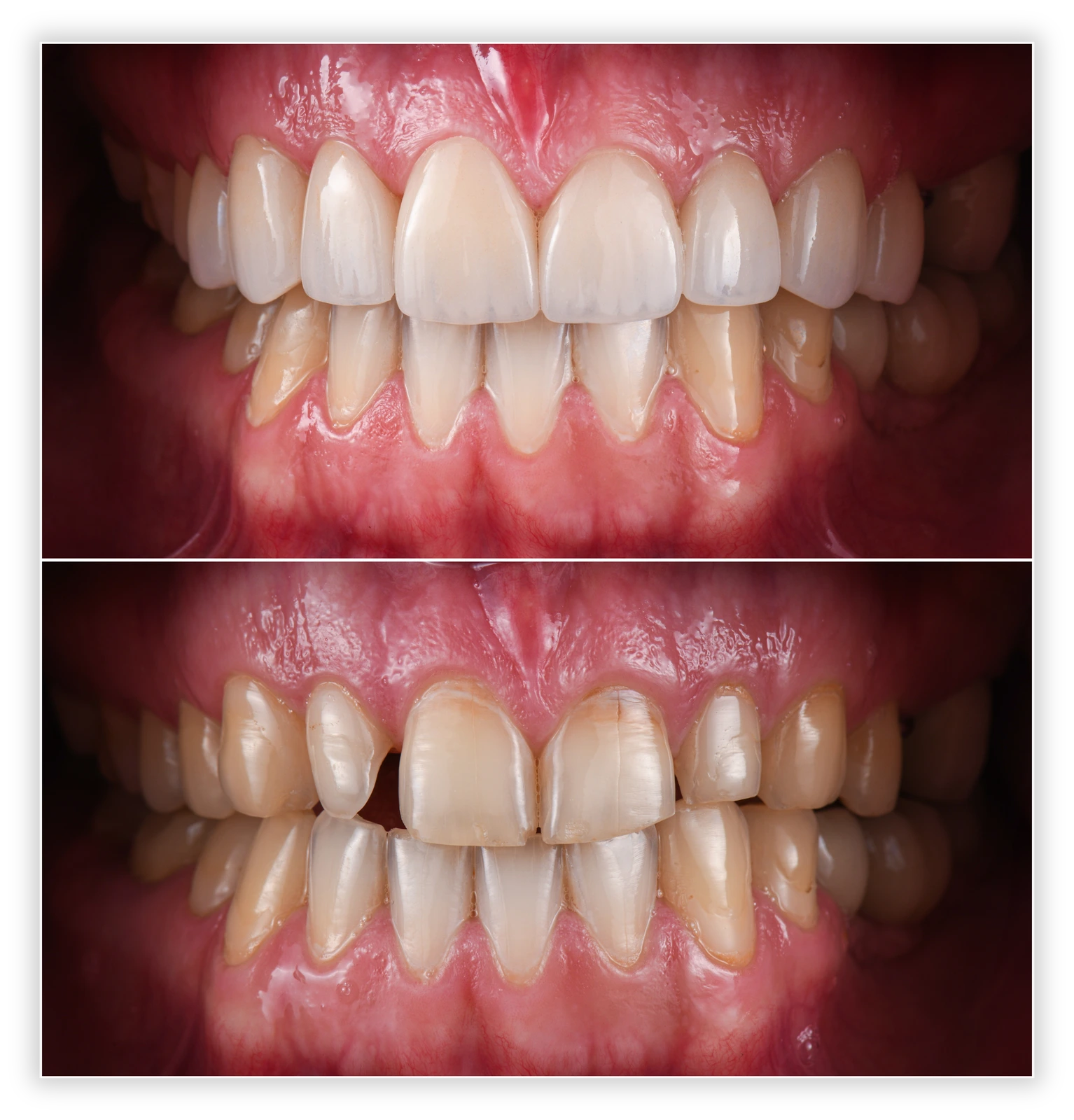Aesthetic Dental Work